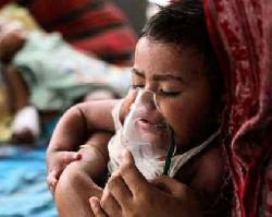 হাম ও হামের উপসর্গে মৃত্যু ৭০০ ছাড়াল