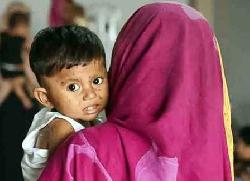 হামের উপসর্গ নিয়ে আরও ২ শিশুর মৃত্যু 